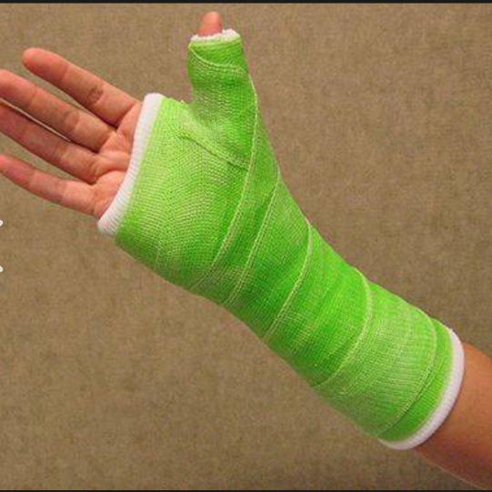 Is a Broken Bone the Same as a Fracture?